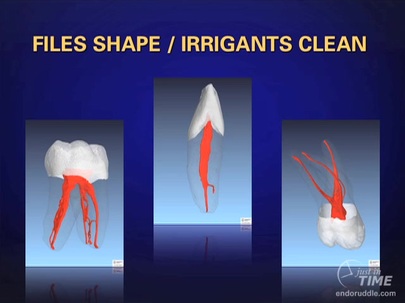 Root Canal Disinfection Using Highly Effective Aggregation-Induced