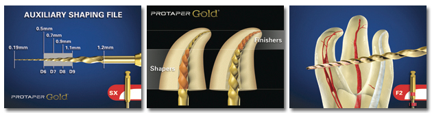 rotary files in endodontics