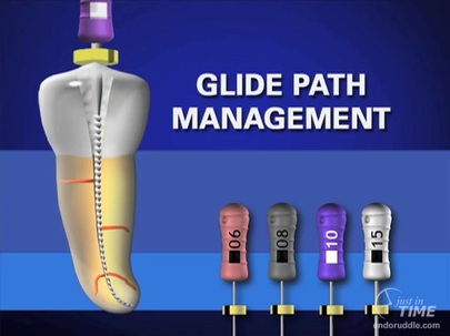 Glide Path Management - Preparation Sequence